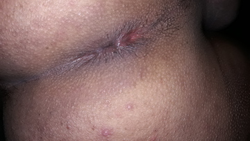 Some more photo 11